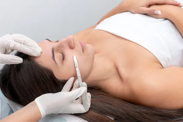 Dermaplaning treatment