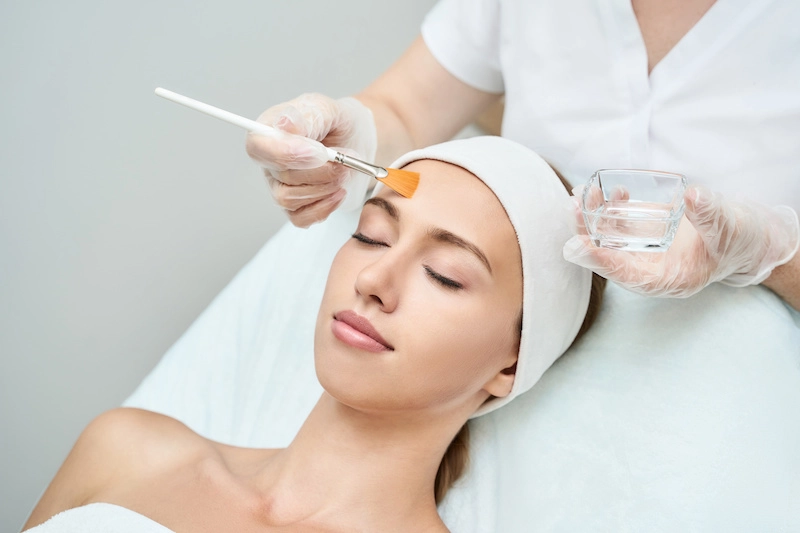 Chemical peels in Redlands - professional peel treatment